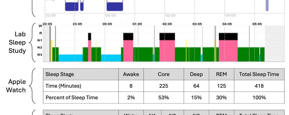 Sleep Tracker vs Sleep Study: When You Need a Sleep Lab